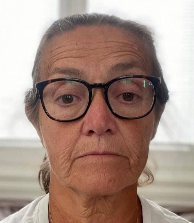 Kvinne med briller som får behandling for muskelsmerter og skjelettplager på klinikken.